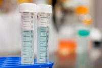 Test na Helicobacter - dlaczego jest ważny i kiedy należy go wykonać?